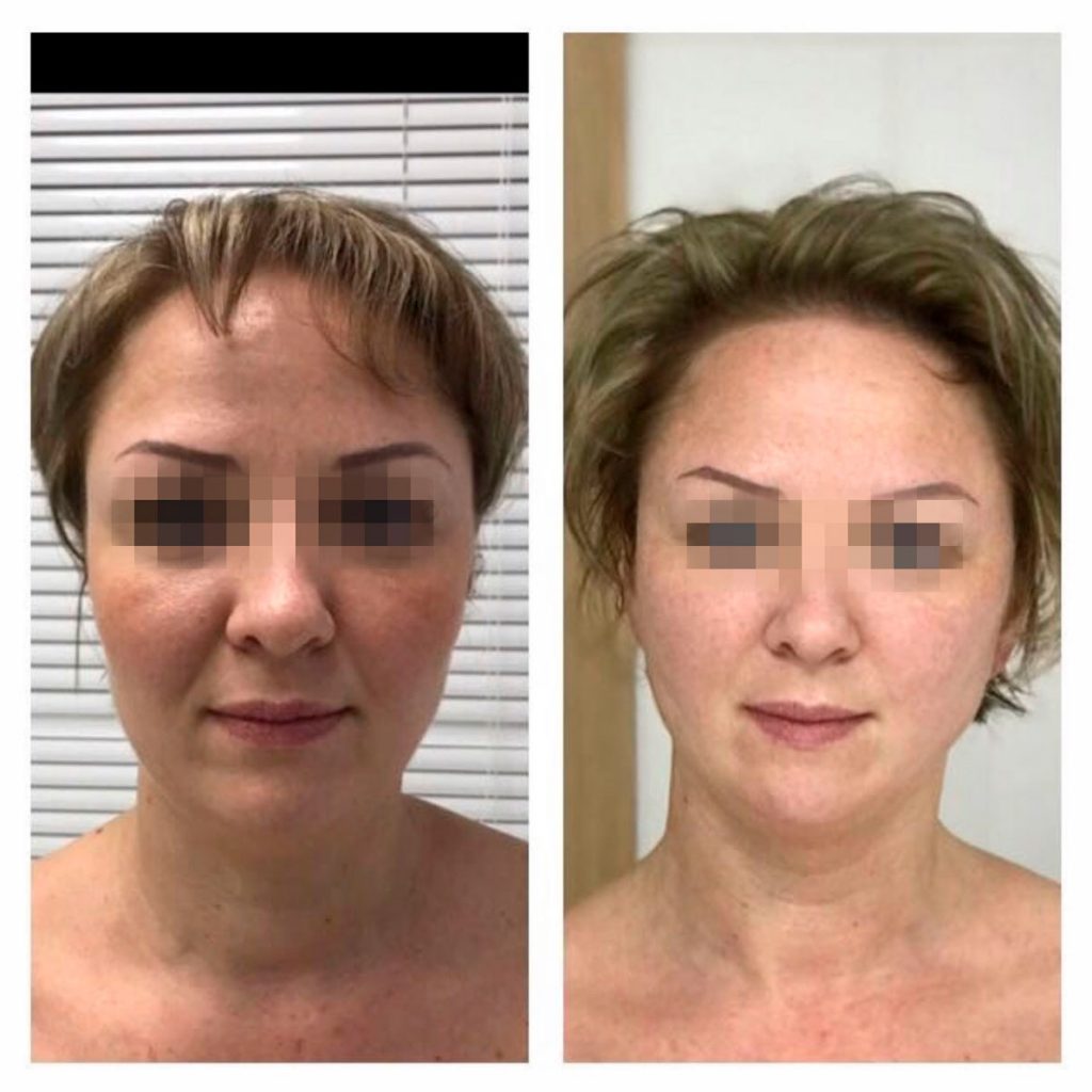 НПЦ детской неврологии, косметология